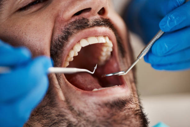 Best Emergency Tooth Extraction in New Richmond, OH